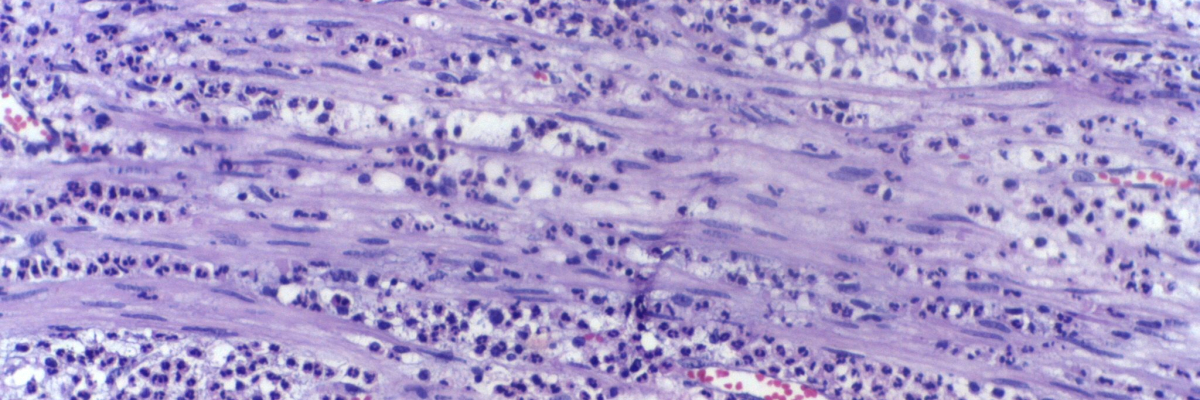 Cover photo - Immunologia clinica e sperimentale