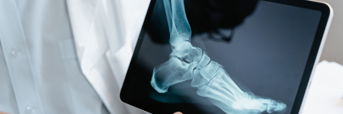 radiografia piede